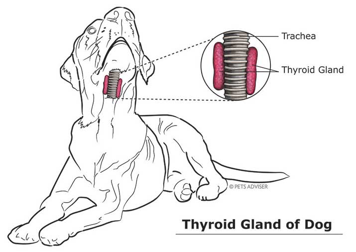 What is Hypothyroidism image of  thyroid gland